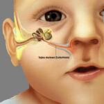 Zapalenie ucha u dziecka