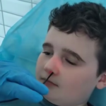 Jak przebiega badanie endoskopowe u dzieci z problemami laryngologicznymi?