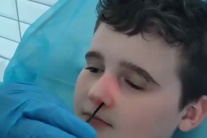 Jak przebiega badanie endoskopowe u dzieci z problemami laryngologicznymi?